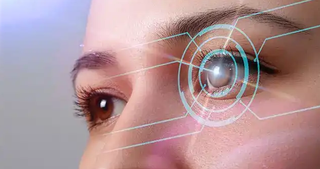 Laser Refractive Cataract Surgery